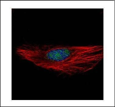 Anti-RBM28 Antibody