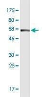 Anti-YWHAZ Antibody