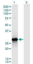 Anti-YWHAZ Antibody
