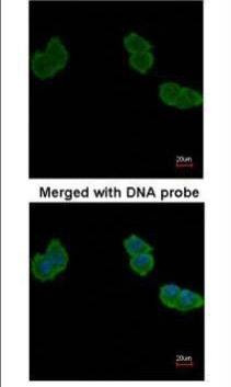 Anti-Aminoacylase 1 Antibody