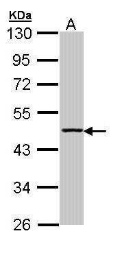 Anti-Aminoacylase 1 Antibody