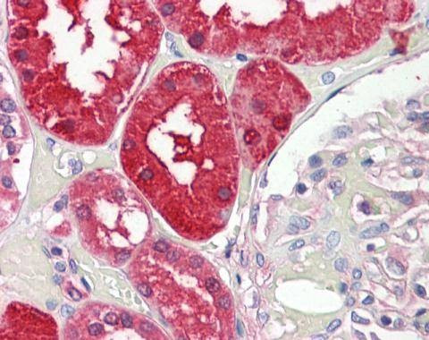 Anti-Aminoacylase 1 Antibody