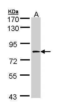 Anti-Factor XIIIa Antibody