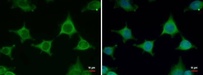 Anti-Fatty Acid Synthase (N-term) Antibody
