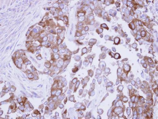 Anti-Fatty Acid Synthase (N-term) Antibody