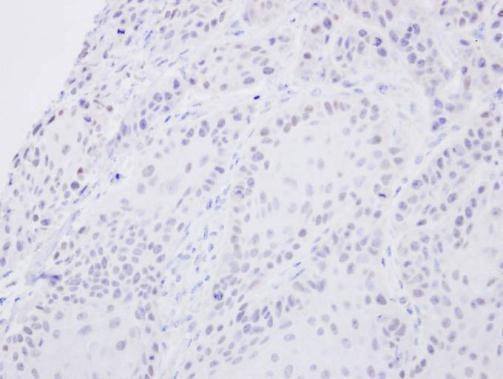 Anti-SENP2 (N-term) Antibody