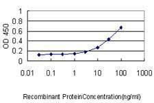 Anti-ZAK Antibody