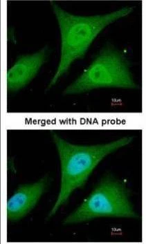 Anti-IKB alpha Antibody