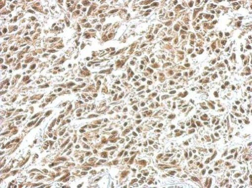 Anti-IKB alpha Antibody