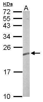 Anti-TC21 Antibody