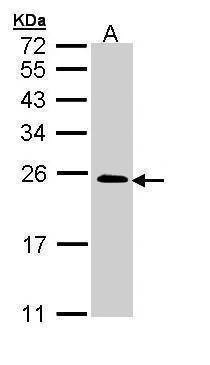 Anti-TC21 Antibody
