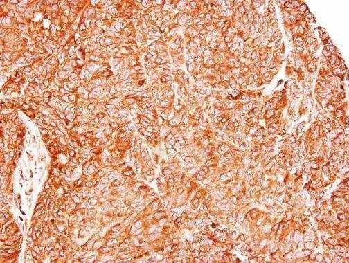 Anti-TC21 Antibody