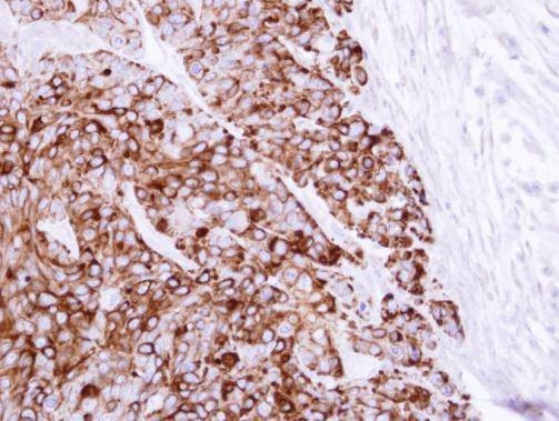 Anti-Cytokeratin 20 (internal) Antibody