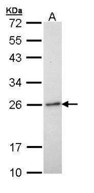 Anti-RAB6A Antibody