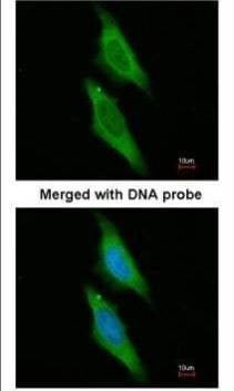 Anti-ARA9 Antibody