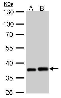 Anti-PEX19 Antibody