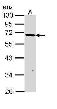 Anti-PSR Antibody