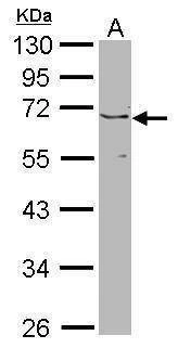 Anti-PSR Antibody