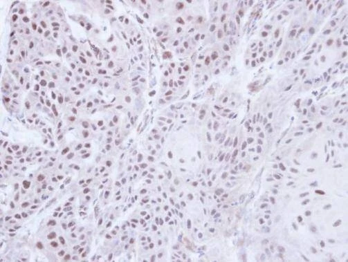 Anti-PSR Antibody