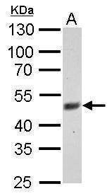 Anti-FBXL3 Antibody