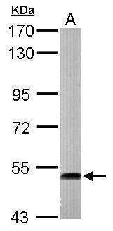 Anti-ATP6V1H Antibody