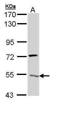 Anti-ATP6V1H Antibody