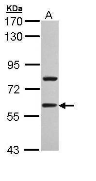 Anti-TBLR1 Antibody
