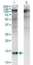 Anti-ZBTB16 Antibody