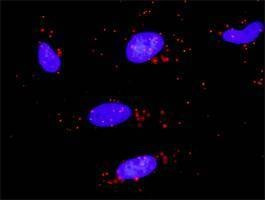 Anti-ZBTB16 Antibody
