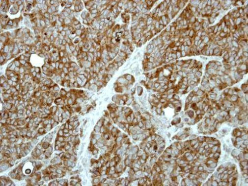 Anti-MP1 Antibody