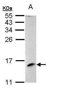 Anti-MP1 Antibody