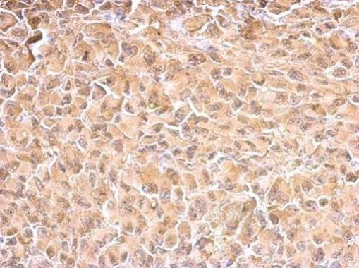 Anti-HSP70 1A Antibody