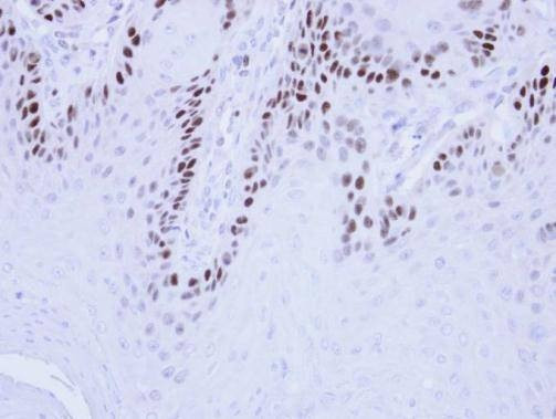 Anti-MCM3 Antibody