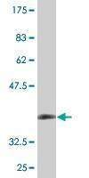 Anti-ZDHHC13 Antibody