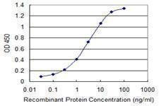 Anti-ZDHHC13 Antibody