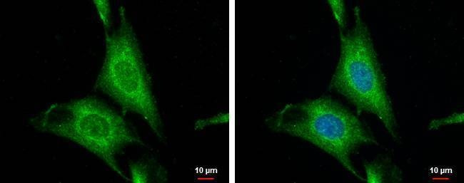Anti-WNT10A Antibody