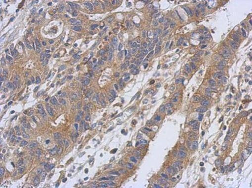 Anti-PKC alpha Antibody