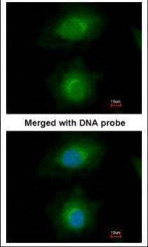 Anti-MVD Antibody