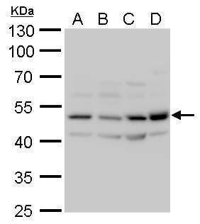 Anti-CaMKII delta Antibody