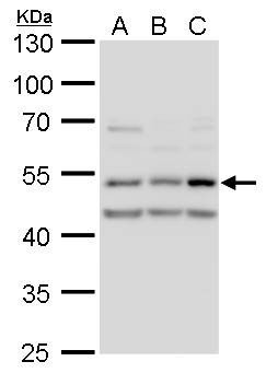 Anti-CaMKII delta Antibody