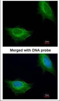 Anti-ADCK1 Antibody