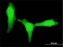 Anti-ZEB1 Antibody