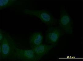 Anti-ZEB1 Antibody
