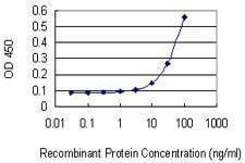 Anti-ZEB1 Antibody