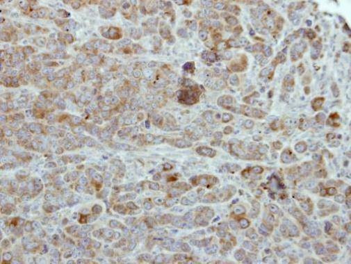 Anti-ULK2 (C-term) Antibody