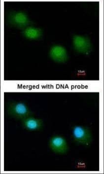 Anti-Ubiquilin-1 Antibody