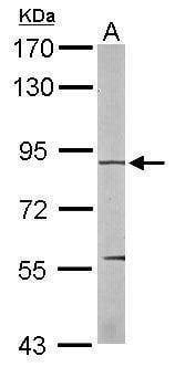 Anti-EEF2K Antibody