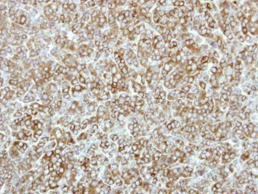 Anti-EEF2K Antibody