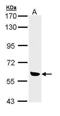 Anti-OXSR1 Antibody