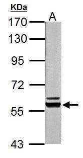Anti-Pyruvate Kinase (liver/RBC) Antibody